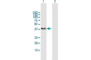 Western Blot analysis of SFRS5 expression in transfected 293T cell line by SFRS5 MaxPab polyclonal antibody. (SRSF5 抗体  (AA 1-272))