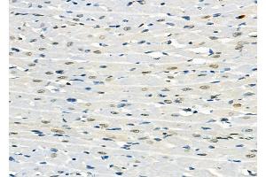 ABIN6257906 and ABIN6274713 at 1/100 staining Rat heart tissue by IHC-P. (AGPAT3 抗体  (Internal Region))