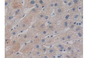 Detection of DCLK1 in Human Liver Tissue using Polyclonal Antibody to Doublecortin Like Kinase 1 (DCLK1) (DCLK1 抗体  (AA 390-647))