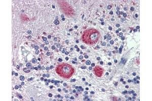 GRHL2 antibody was used for immunohistochemistry at a concentration of 4-8 ug/ml. (GRHL2 抗体  (Middle Region))