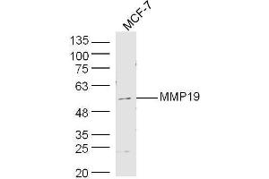 Human MCF-7 cell lysates probed with Rabbit Anti-MMP19 Polyclonal Antibody, Unconjugated  at 1:500 for 90 min at 37˚C. (MMP19 抗体  (AA 251-350))