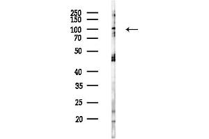 anti-G Protein Regulated Inducer of Neurite Outgrowth 1 (GPRIN1) (Internal Region) antibody