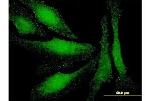 Immunofluorescence of monoclonal antibody to LMO3 on HeLa cell. (LMO3 抗体  (AA 91-146))