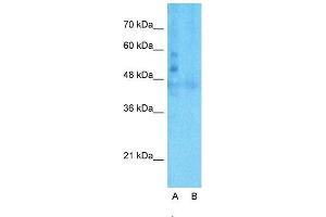 Host:  Rabbit  Target Name:  LSR  Sample Type:  Human Fetal Liver  Lane A:  Primary Antibody  Lane B:  Primary Antibody + Blocking Peptide  Primary Antibody Concentration:  1ug/ml  Peptide Concentration:  5ug/ml  Lysate Quantity:  25ug/lane/lane  Gel Concentration:  0. (LSR 抗体  (C-Term))
