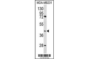 Western blot analysis of HOMER3 Antibody in MDA-MB231 cell line lysates (35ug/lane) (HOMER3 抗体  (AA 281-308))