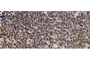 Immunohistochemistry of paraffin-embedded Human tonsil tissue using SIK3 Polyclonal Antibody at dilution of 1:60(x200) (SIK3 抗体)