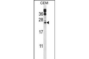 RAB6B Antibody (C-term) (ABIN657771 and ABIN2846747) western blot analysis in CEM cell line lysates (35 μg/lane). (RAB6B 抗体  (C-Term))