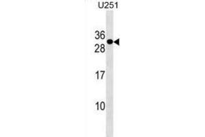 Western Blotting (WB) image for anti-POM121 and ZP3 Fusion (POMZP3) antibody (ABIN3000214) (POMZP3 抗体)