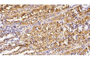 Detection of EPCAM in Porcine Stomach Tissue using Polyclonal Antibody to Epithelial Cell Adhesion Molecule (EPCAM)