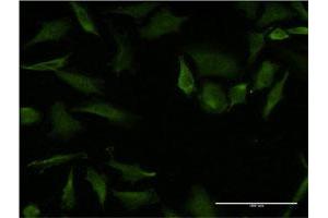 Immunofluorescence of monoclonal antibody to RHOA on HeLa cell. (RHOA 抗体  (AA 1-193))