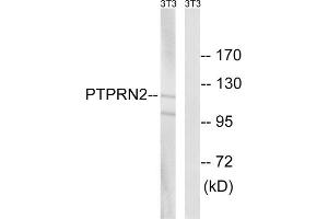 Western blot analysis of extracts from NIH/3T3 cells, using PTPRN2 antibody. (PTPRN2 抗体  (Internal Region))
