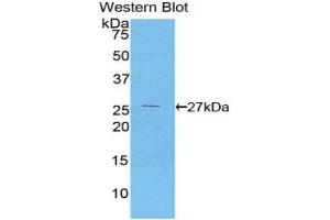 Western Blotting (WB) image for anti-Coagulation Factor XII (F12) (AA 400-615) antibody (ABIN1858750) (F12 抗体  (AA 400-615))