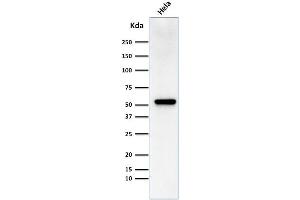 Western Blot Analysis of HeLa cell lysate using Fascin-1 Mouse Monoclonal Antibody (FSCN1/418) (Fascin 抗体)