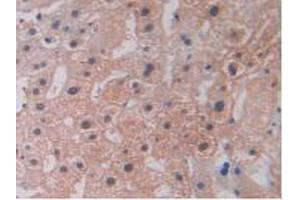 IHC-P analysis of Human Liver Tissue, with DAB staining. (LOXL2 抗体  (AA 544-751))