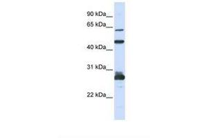 Image no. 1 for anti-Pescadillo Ribosomal Biogenesis Factor 1 (PES1) (C-Term) antibody (ABIN6739037) (PES1 抗体  (C-Term))
