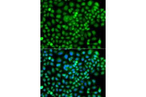 Immunofluorescence analysis of A549 cell using SUMO4 antibody. (SUMO4 抗体)