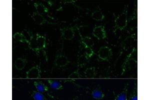 Immunofluorescence analysis of C6 cells using GLUD1 Polyclonal Antibody at dilution of 1:100. (GLUD1 抗体)