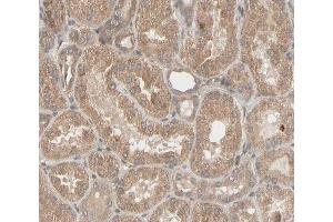 ABIN6266596 at 1/100 staining human kidney tissue sections by IHC-P. (MMP3 抗体  (C-Term))