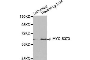 Western blot analysis of extracts from A431 cells using Phospho-MYC-S373 antibody. (c-MYC 抗体  (pSer373))