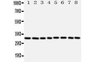 Western Blotting (WB) image for anti-Voltage-Dependent Anion Channel 1 (VDAC1) (AA 163-178), (Middle Region) antibody (ABIN3044167) (VDAC1 抗体  (Middle Region))
