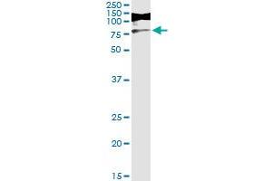 Immunoprecipitation of RIOK3 transfected lysate using anti-RIOK3 monoclonal antibody and Protein A Magnetic Bead , and immunoblotted with RIOK3 MaxPab rabbit polyclonal antibody. (RIOK3 抗体  (AA 1-516))