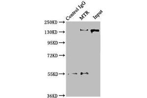 Immunoprecipitating MTR in Hela whole cell lysate Lane 1: Rabbit control IgG instead of ABIN7159585 in Hela whole cell lysate. (MTR 抗体  (AA 923-1265))
