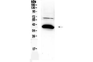 Western blot analysis of Bag1 using anti-Bag1 antibody . (BAG1 抗体  (C-Term))