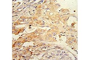 Immunohistochemistry (IHC) image for anti-PTEN Induced Putative Kinase 1 (PINK1) antibody (ABIN3028956)