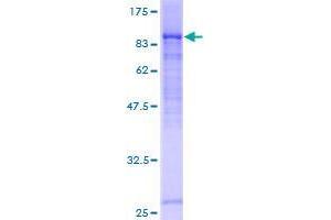 DCP1B Protein (AA 1-618) (GST tag)