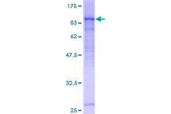 DCP1B Protein (AA 1-618) (GST tag)