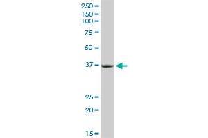 PRKRA MaxPab rabbit polyclonal antibody.