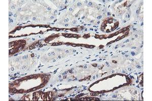 Image no. 1 for anti-phosphofructokinase, Platelet (PFKP) antibody (ABIN1500164) (PFKP 抗体)