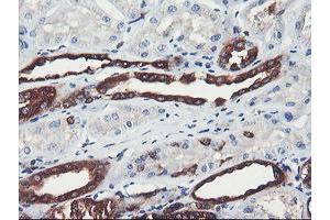 Image no. 1 for anti-phosphofructokinase, Platelet (PFKP) antibody (ABIN1500164) (PFKP 抗体)