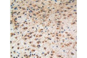 Used in DAB staining on fromalin fixed paraffin- embedded brain tissue (IGF2R 抗体  (AA 1148-1365))