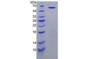 SDS-PAGE analysis of Human Perforin 1 Protein. (Perforin 1 蛋白)