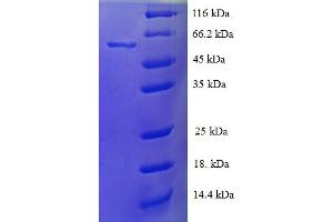 SDS-PAGE (SDS) image for Cytochrome P450, Family 21, Subfamily A, Polypeptide 2 (CYP21A2) (AA 1-495), (full length) protein (His tag) (ABIN5709379)