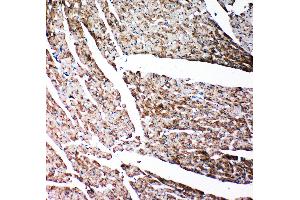 Anti-Gelsolin antibody, IHC(P) IHC(P): Rat Cardiac Muscle Tissue (Gelsolin 抗体  (C-Term))