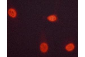 ABIN6267223 staining HeLa cells by ICC/IF. (CHEK1 抗体  (pSer301))