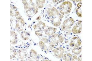 Immunohistochemistry of paraffin-embedded Human stomach using ALKBH4 Polyclonal Antibody at dilution of 1:100 (40x lens). (ALKBH4 抗体)