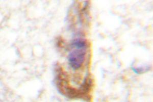 Image no. 1 for anti-Protein Kinase C, zeta (PRKCZ) antibody (ABIN272064) (PKC zeta 抗体)