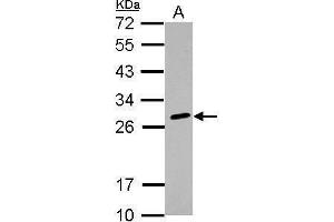 WB Image Sample (30 ug of whole cell lysate) A: K562 12% SDS PAGE antibody diluted at 1:1000