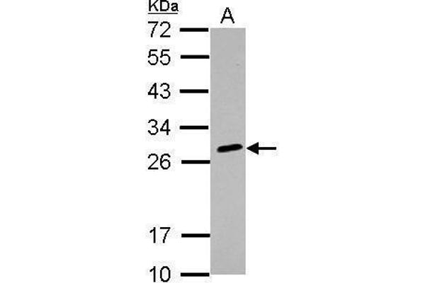 HLA-DQB2 anticorps