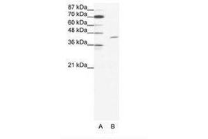 Image no. 1 for anti-T-Cell Acute Lymphocytic Leukemia 1 (TAL1) (C-Term) antibody (ABIN202265) (TAL1 抗体  (C-Term))