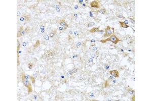 Immunohistochemistry of paraffin-embedded Rat brain using ABCB8 Polyclonal Antibody at dilution of 1:100 (40x lens).