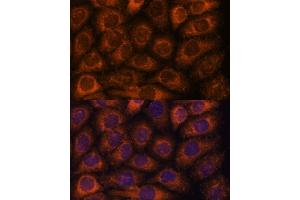 Immunofluorescence analysis of HeLa cells using CCT6B antibody (ABIN7270709) at dilution of 1:100. (CCT6B 抗体  (AA 120-340))