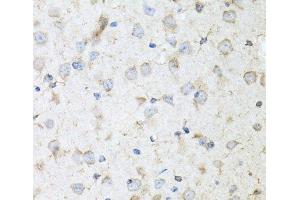 Immunohistochemistry of paraffin-embedded Mouse brain using KLK11 Polyclonal Antibody at dilution of 1:100 (40x lens). (Kallikrein 11 抗体)