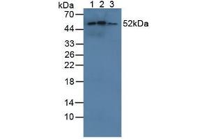 Figure. (CYP21A2 抗体  (AA 37-264))
