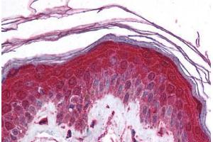 Human Skin (formalin-fixed, paraffin-embedded) stained with KCNN3 antibody ABIN214788 at 5 ug/ml followed by biotinylated goat anti-rabbit IgG secondary antibody ABIN481713, alkaline phosphatase-streptavidin and chromogen. (KCNN3 抗体  (AA 642-691))