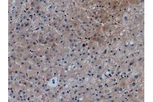Detection of CCL27 in Human Liver Tissue using Monoclonal Antibody to Chemokine (C-X-C Motif) Ligand 27 (CCL27) (Chemokine (C-X-C Motif) Ligand 27 (AA 25-112) 抗体)