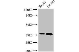 Western Blot Positive WB detected in: HepG2 whole cell lysate, Jurkat whole cell lysate All lanes: TYMS antibody at 2. (TYMS 抗体  (AA 2-54))